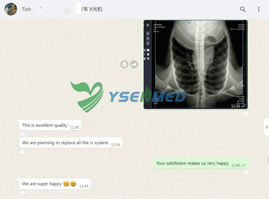 YSENMED YSX500D 50kW medical digital x-ray system.