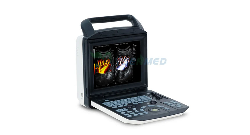 Escaneo de riñón en modo color con el ecógrafo portátil en color YSENMED YSB-M5.