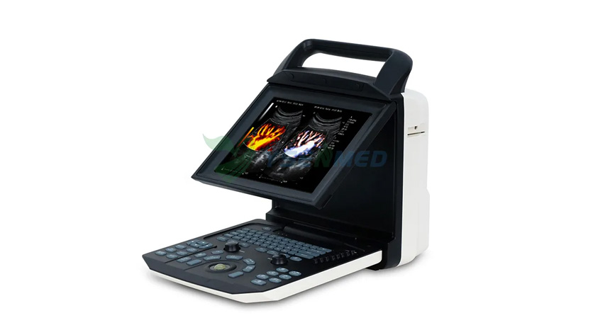 Balayage de la thyroïde en mode couleur avec l'échographe Doppler couleur portable YSENMED YSB-M5.
