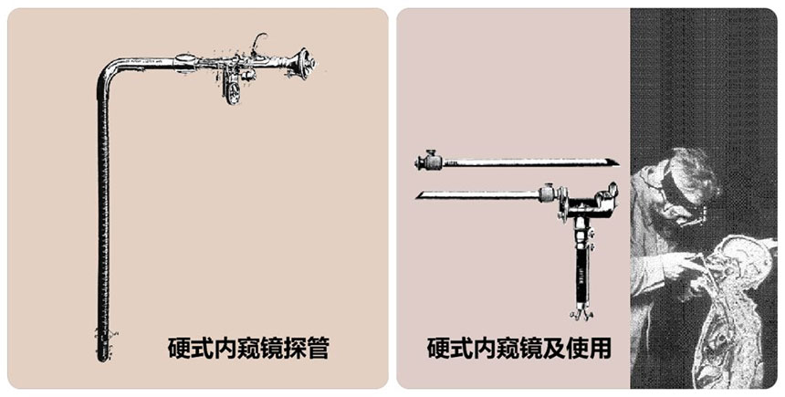 rigid endoscope