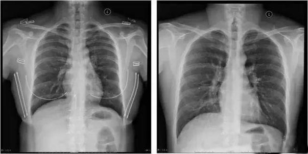 Cuatro malentendidos comunes sobre la realización de radiografías