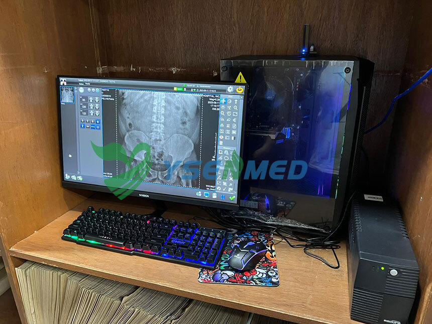 El detector YSENMED DR YSFPD-M1717V ayuda a la digitalización de radiografías en un hospital de Filipinas.