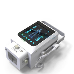 Unidad de rayos X portátil digital YSENMED de 5,6 kW YSX056-PD