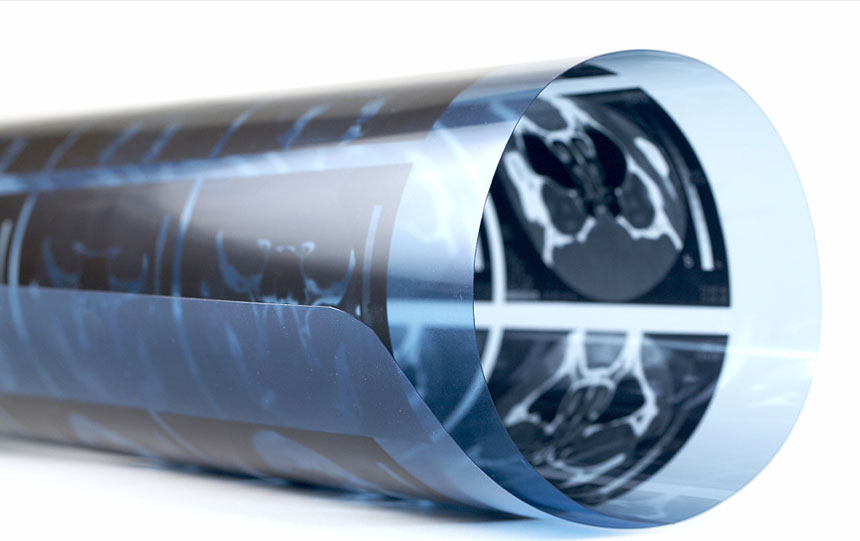 Precautions for daily storage and use of medical X-ray films