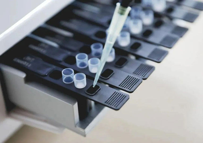 Summary of detection principles, methods, and analysis parameter settings of fully automatic biochemical analyzers!