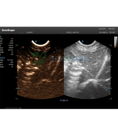 Ecoendoscopio de matriz lineal Sonoscape EG-UC5T