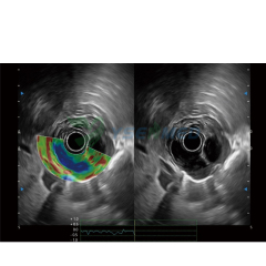 Ecoendoscopio de matriz lineal Sonoscape EG-UR5