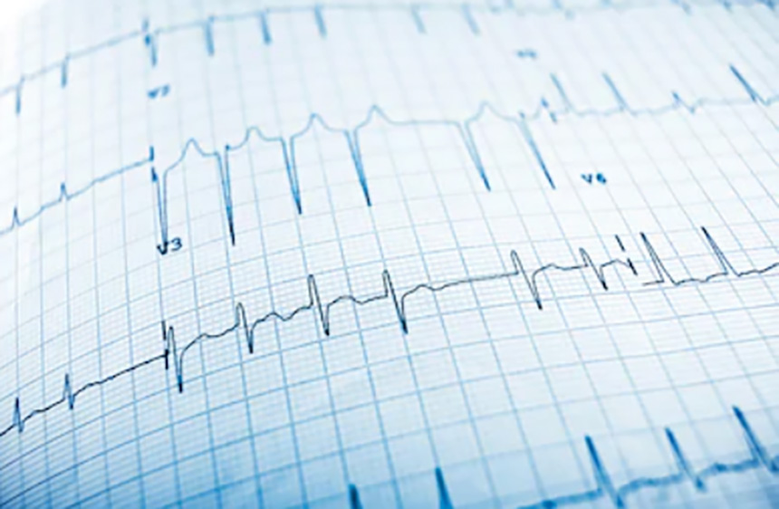 Medición de electrocardiograma, algo de sentido común que debes saber