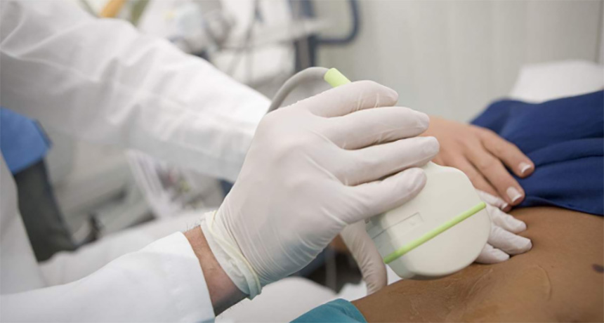 Doppler effect in medical imaging technology