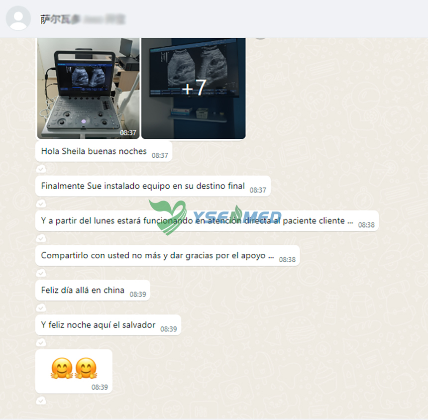 SonoScape E2 customer feedback