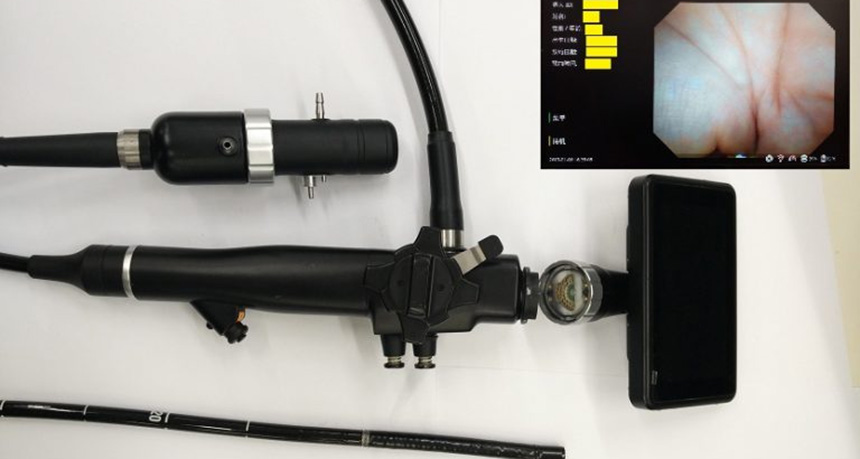 What are the basic components and principles of the endoscopic camera system?