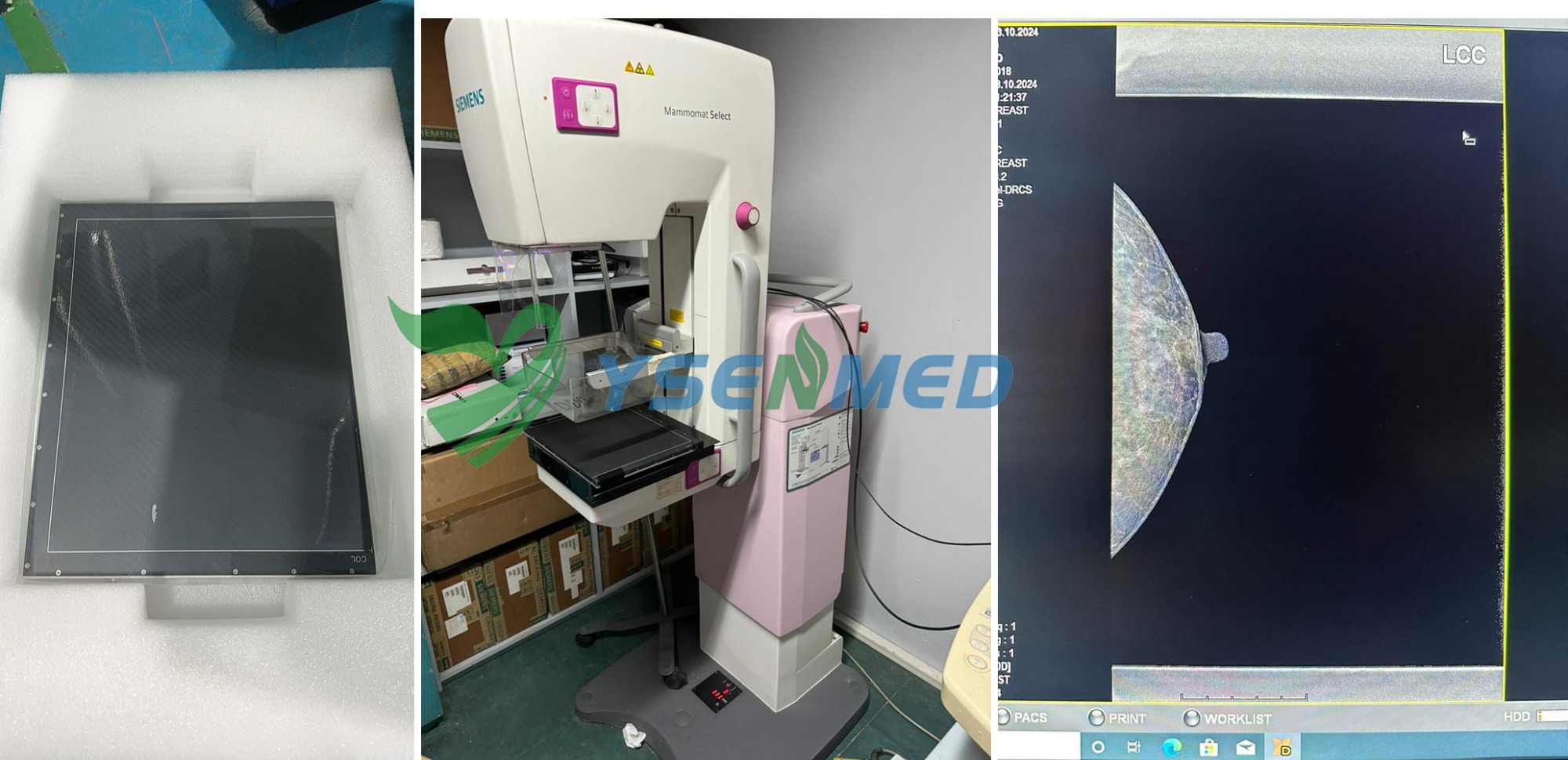 Qualité d'image du détecteur de mammouth YSFPD-R1012C hautement reconnue par un médecin philippin