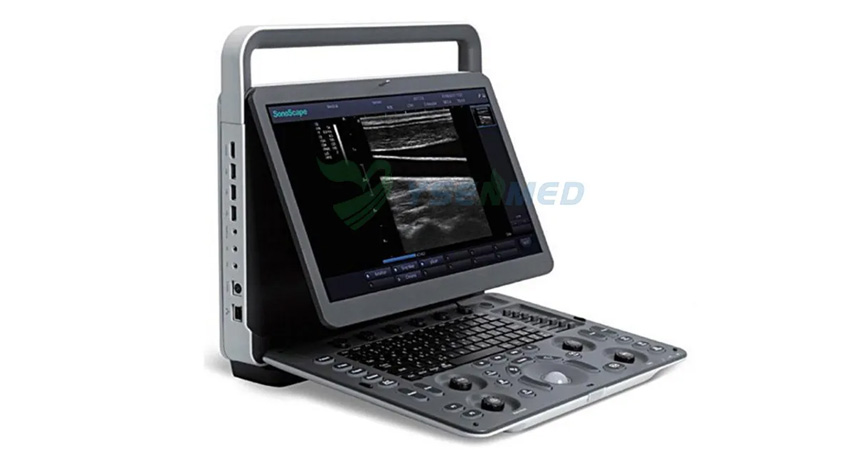 Explore the future of portable ultrasound machines