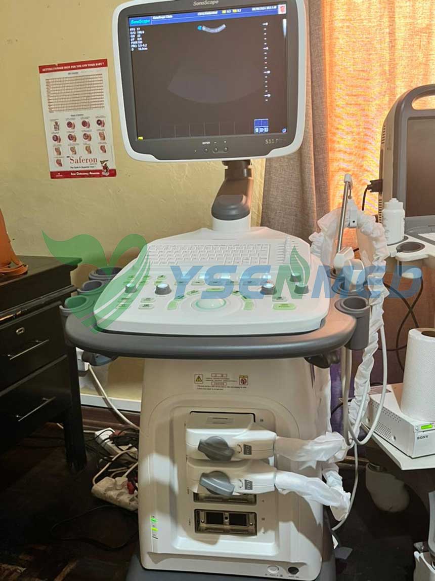 L'échographe couleur SonoScape S11 Plus fonctionne bien dans un hôpital africain