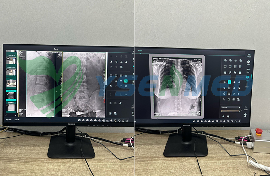 x-ray system