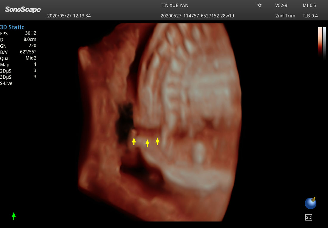 Sonoscape P60 mobile ultrasound doppler machines for sales