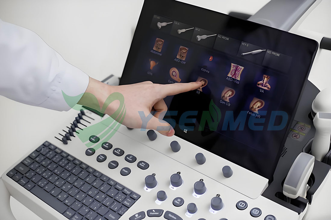 The Future of Sonoscape Ultrasound