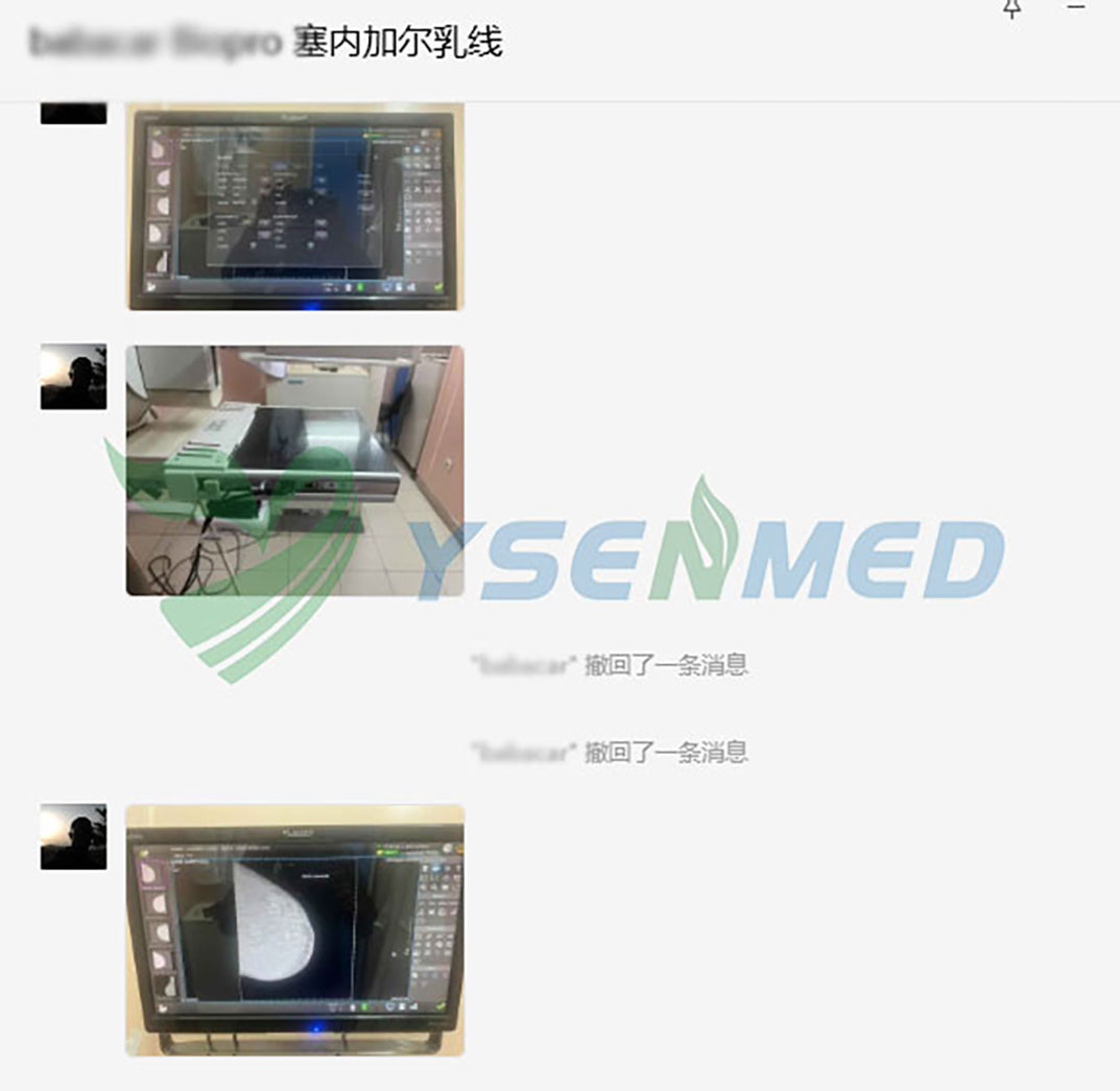mammography x-ray system