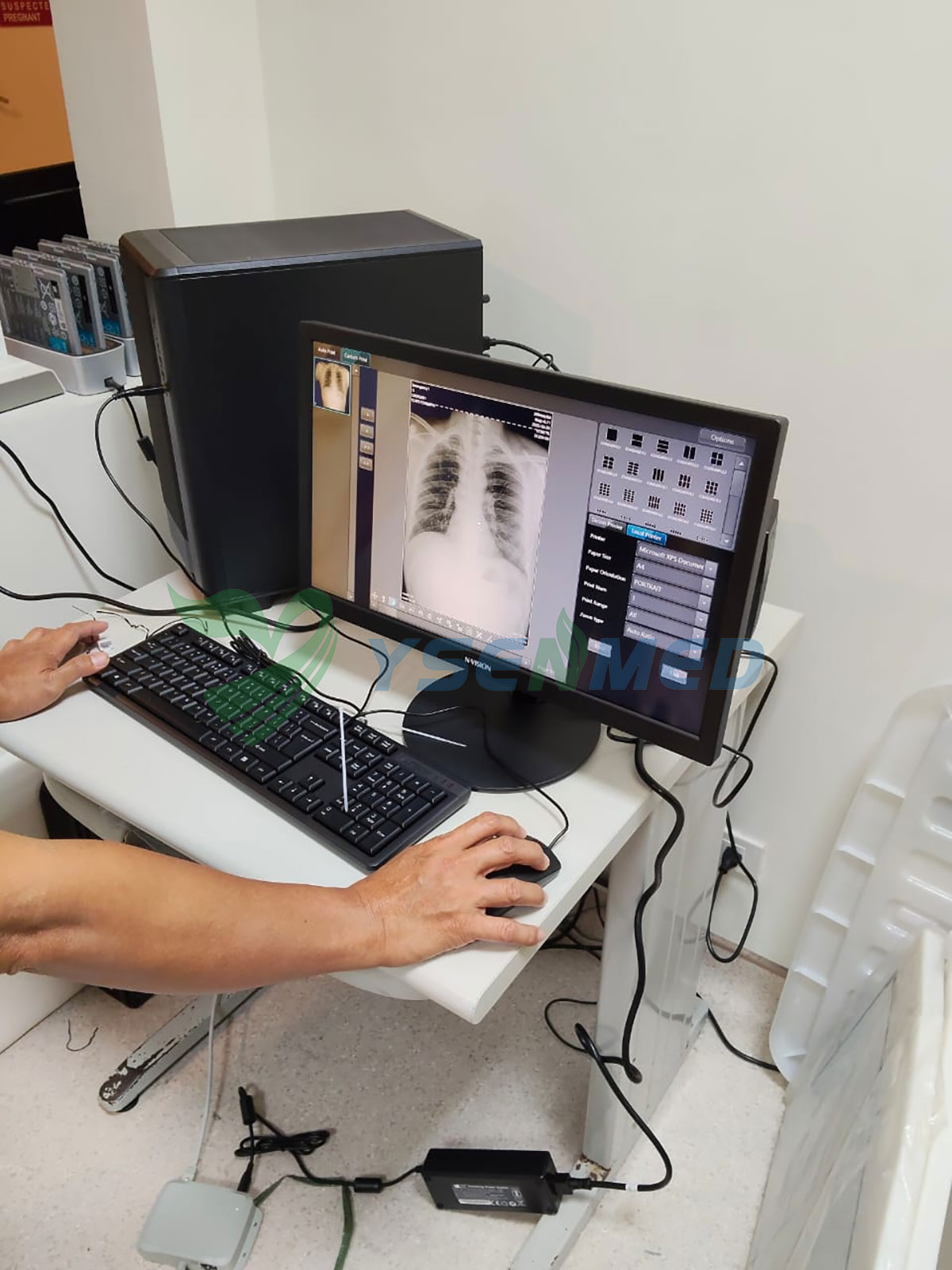 Le docteur Jnueva, des Philippines, apprécie vivement la qualité d'image du détecteur à panneau YSFPD-V1717X.