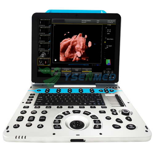Système d'échographie couleur portable médical 3D 4D 5D YSB-P30