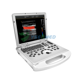 Medical Laptop Portable Color Ultrasound System YSB-L3