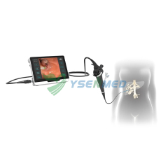 Video Choledochoscope YSNJ-CH1331