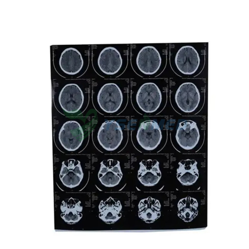 Película térmica seca para rayos X médicos YSX-JP
