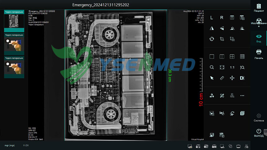 Russia Case: 5.6kW Mobile X-Ray with Portable Flat Panel Detector