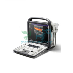 Portable Color Doppler Ultrasound S6