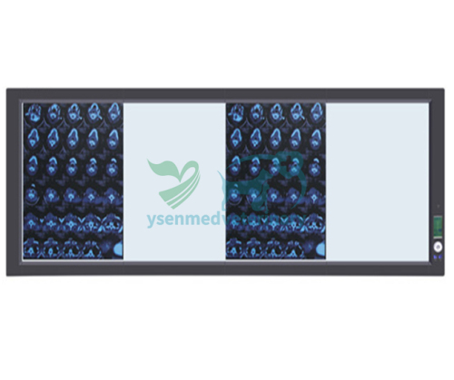 LED Negatoscope / LED Film Viewer / LED Film Illuminator YSX-GPD04