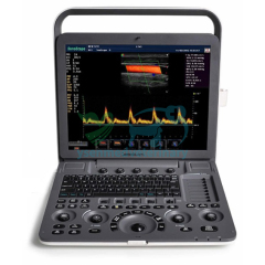 Portable color doppler ultrasound sonoscape S9 Pro