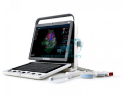 Portable 3D 4D color doppler ultrasound Sonoscape S9V