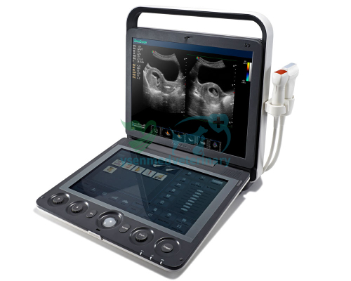 Portable 3D 4D color doppler ultrasound Sonoscape S9V
