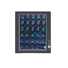 YSENMED Veterinary 5kW Mobile Digital C-arm X-ray System