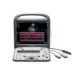 Portable Color Doppler Ultrasound S8V