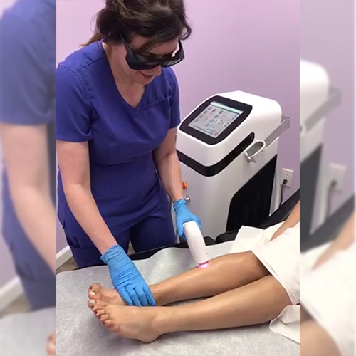 Feedback of vertical diode laser hair removal machine