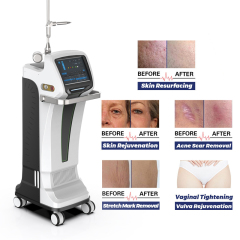 Vertical fractional co2 laser machine