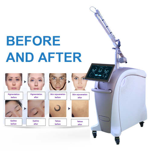 q switched nd yag laser machine