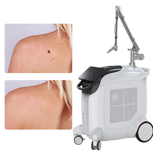 Q switched nd yag laser machine