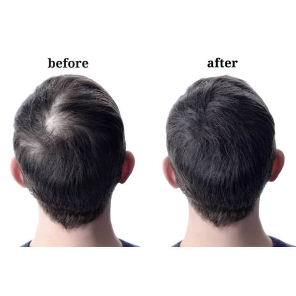 Side Or Back Hair Patches 8x8 cm Full Skin PU Base Toupee For Men Covering Bald Spots On Head Sides Or Back