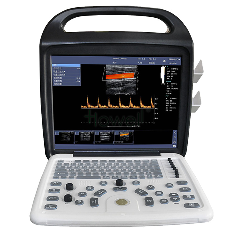 ultrasound machine