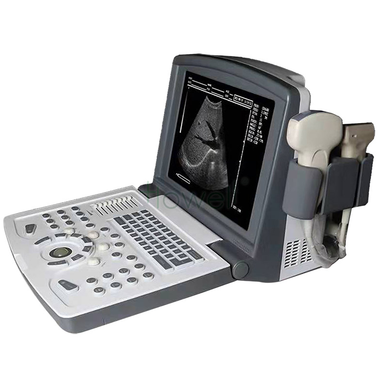 Machine à ultrasons N/B