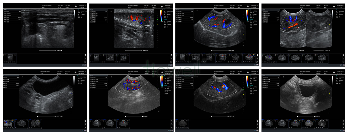 máquina de ultrassom obstétrica