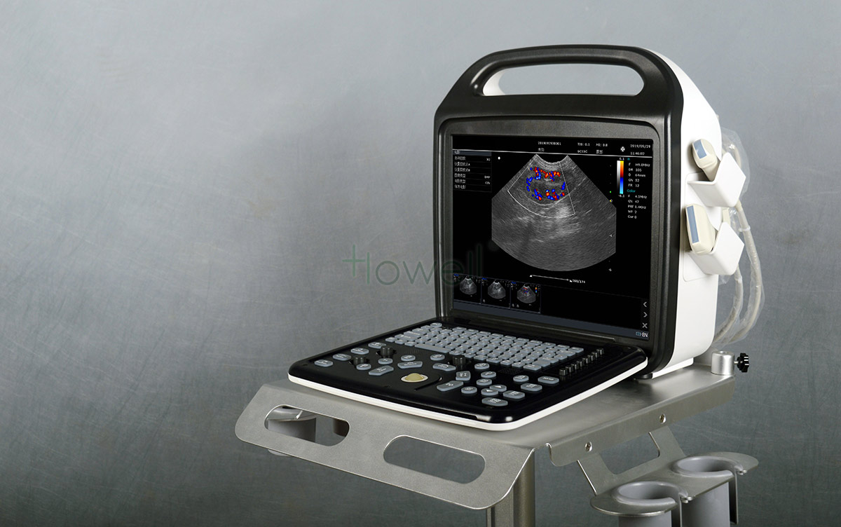 máquina de ultrassom portátil