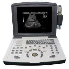 Black And White Ultrasound Machine
