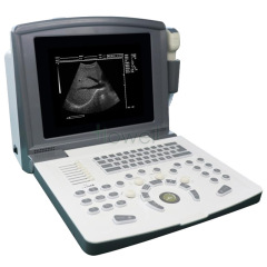 Black And White Ultrasound Machine
