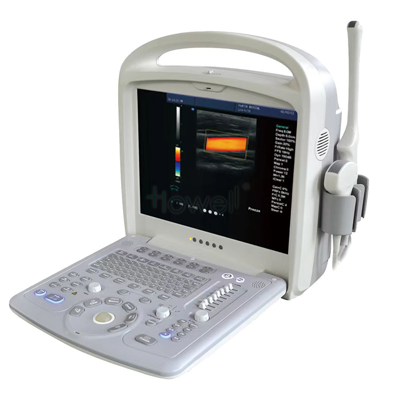 gynecology Ultrasound machine