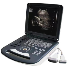 Color Doppler Ultrasound System