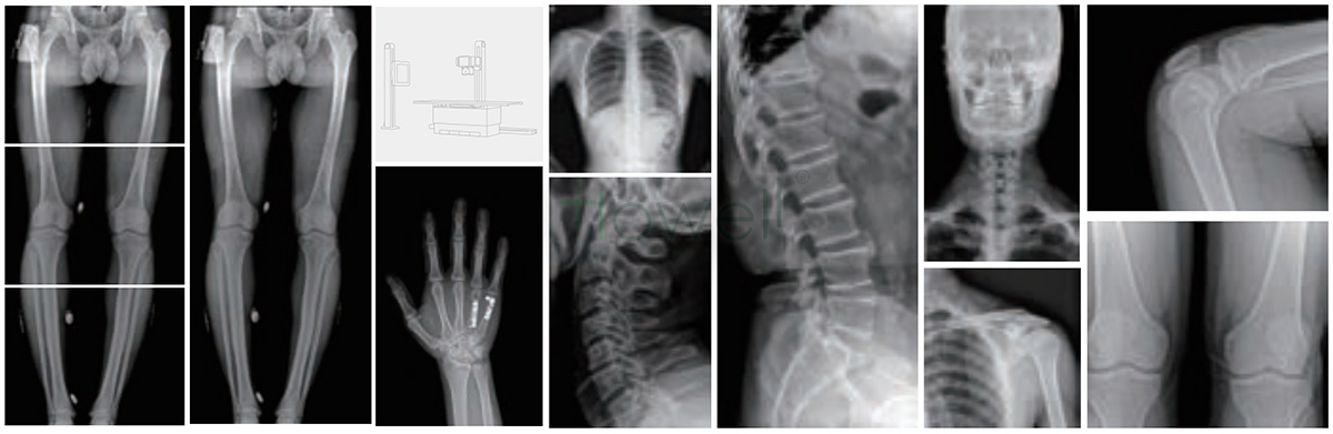 x ray machine price