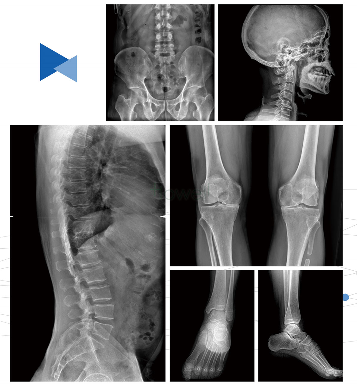 digital x ray machine